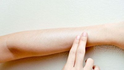 Cara Menjaga Kesehatan Kulit