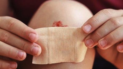 Pemberian Antiseptik Yang Tepat Untuk Penanganan Luka Luar